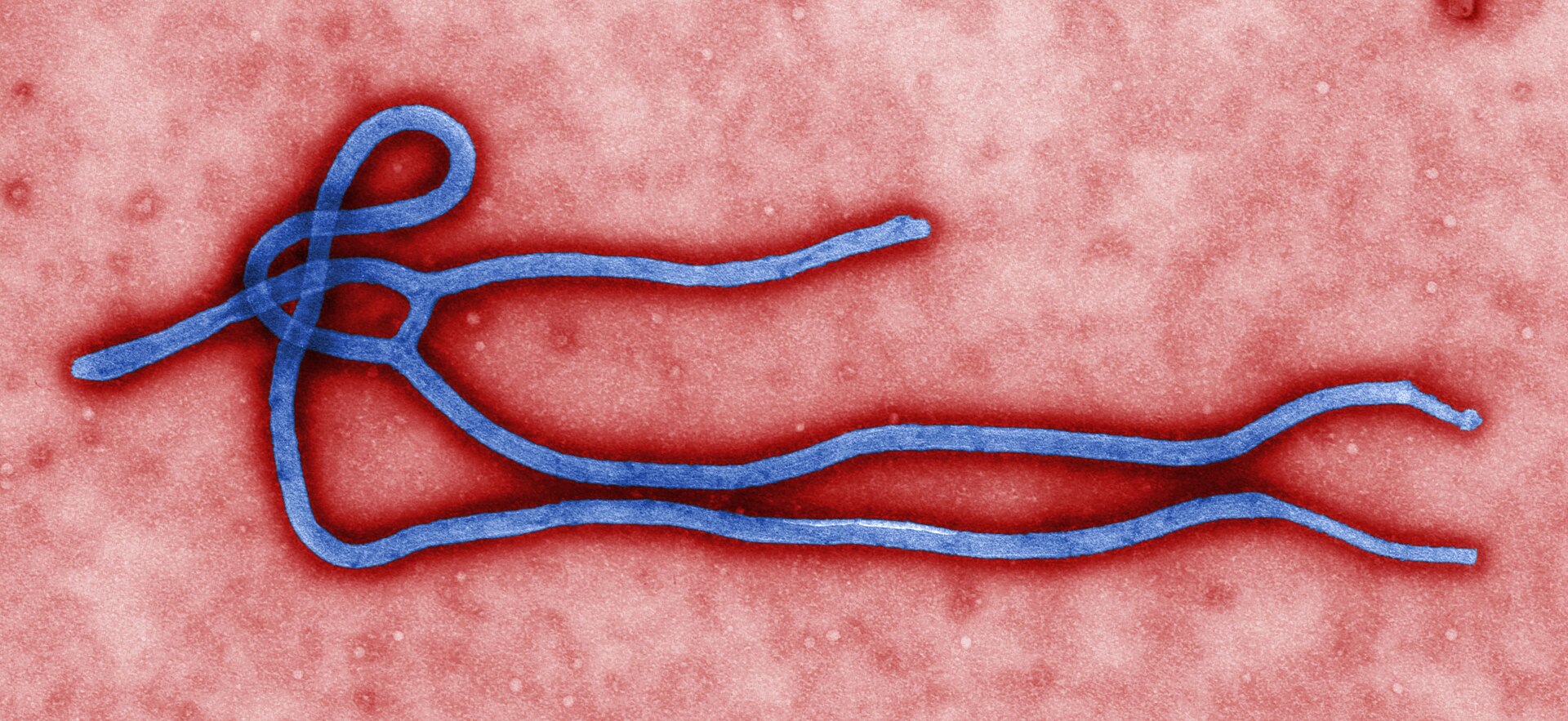 Colorized transmission electron micrograph of an ebolavirus virion